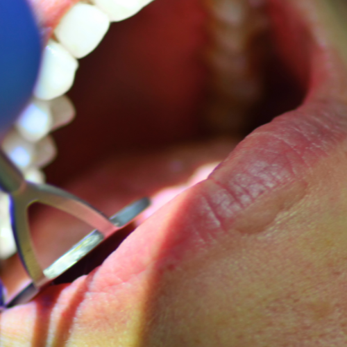 bacterias-bucais-intestinais-usp