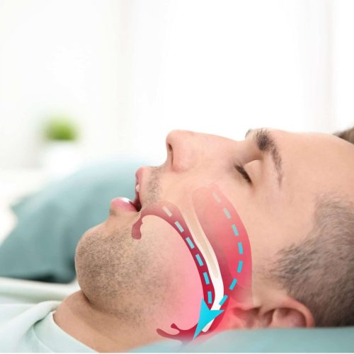 odontologia-do-sono-1